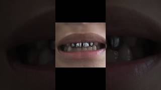 9 out of 10 dentists recommend this film AmericanDentalAssoc colgatesmile [upl. by Mungo]