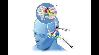 ¿Qué es una audiometria tonal [upl. by Previdi]