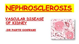 Nephrosclerosis [upl. by Asserrac]