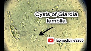 Cysts of Giardia lamblia  Parasitology  labmedicine9265 nohamadboulytahadoodaianew2185 [upl. by Nyliac]