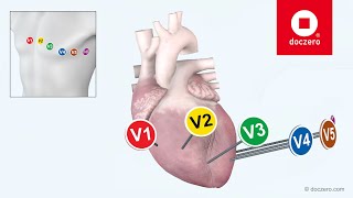 ECG interpretatie  Doczero Elearning [upl. by Nodlew]