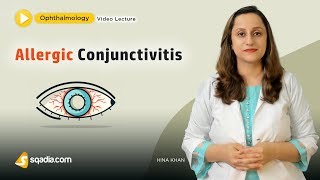 Allergic Conjunctivitis  Ophthalmology Student Lecture  VLearning  sqadiacom [upl. by Sylvie]