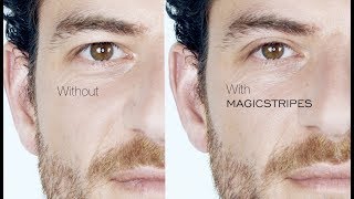 WWWMAGICSTRIPESCOM  Immediate Eyelid Lifting Without Surgery [upl. by Chipman772]