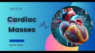 7  Cardiac Imaging for FRCR [upl. by Shay]