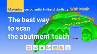 The best way to scan the abutment tooth [upl. by Gustavo22]