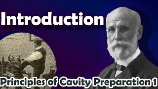 OperativePrinciples of Cavity Preparation 1 [upl. by Natsirhc]