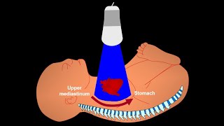 4STIC PART 1 GENERAL RECOMMENDATIONS [upl. by Kramer]