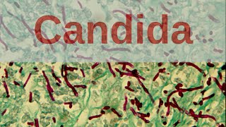 What is Candida  Pathology mini tutorials [upl. by Dorkus]