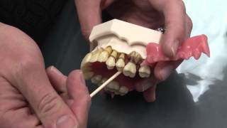 What is Periodontal Disease [upl. by Anilrats]