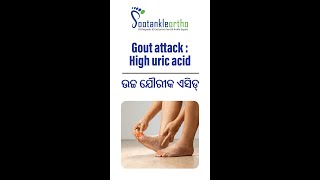 ଉଚ୍ଚ ଯୌରୀକ ଏସିଡ୍  Gout attack  High uric acid [upl. by Azar]