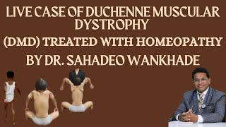 quotLive Case of Duchenne Muscular Dystrophy DMD Treated with Homeopathy BY DR SAHADEO WANKHADE [upl. by Catlaina]