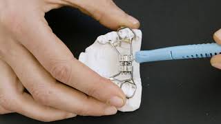 How to turn a palatal expander [upl. by Mcnelly]