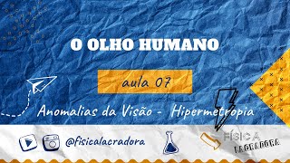 O Olho Humano  aula 07  Hipermetropia Física Lacradora [upl. by Paquito353]