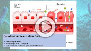 Endotoxine und ein durchlässiger Darm  Leaky Gut Ursache für versteckte Entzündungen [upl. by Eninahs]