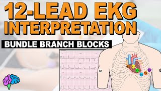 Bundle Branch Blocks MADE EASY  12 Lead EKG [upl. by Sherrod]