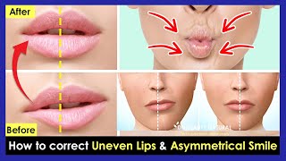 How to correct Uneven Lips Crooked Lips Asymmetrical smile by Facial amp Lips Exercises [upl. by Hildegard]