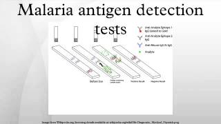 Malaria antigen detection tests [upl. by Katlaps]