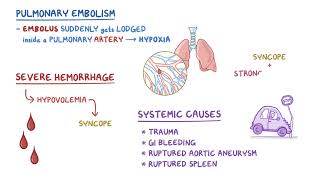 Clinical Reasoning  Syncope  Osmosis [upl. by Aim]