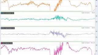 Muse Direct EEG [upl. by Hcaz]