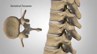 Myelopathy  Patient Education [upl. by Nomelif]