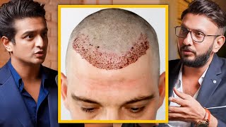 Affordable Hair Transplant In India  Cost Side Effects amp Precautions Explained By Top Dermat [upl. by Winser]