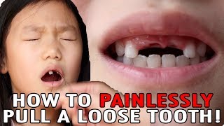 How To Pull A Loose Tooth  No Cry Teeth Pulling Method  Easily Extract Baby Teeth [upl. by Akinej]