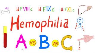 Hemophilia Types  hemophilia A Hemophilia B and Hemophilia C  Comparison  Genetics Hematology [upl. by Loos28]