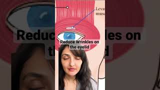 Treating wrinkly amp crepey eyelidseyelidsurgery wrinkles skincare desi nri bollywood indian [upl. by Kobi]