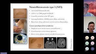 20241016 Neurofibromatosis [upl. by Annette]