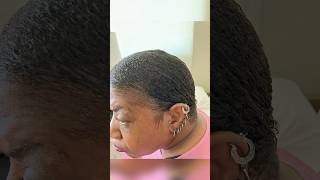 Before and After Hair Growth Results howtogrowyourhairfaster [upl. by Dymoke110]