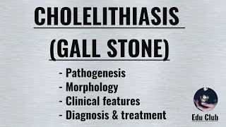 Cholelithiasis Gall Stone  Cholesterol stone  Pigment stone [upl. by Demetria]