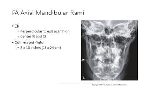 Radiographic Positioning of the Mandible [upl. by Maurili]