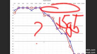 Смысл аудиограммы и алгоритм работы слухового аппарата АЧХ Практика Исправления слуха [upl. by Weinshienk570]