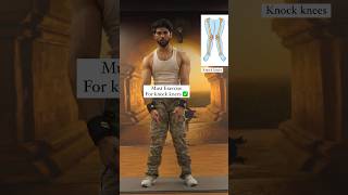 2 Knock Knees Exercise  Shurufit India  youtubeshorts shorts [upl. by Ialokin]