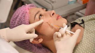 Dermal Filler Injection Techniques [upl. by Mixie827]