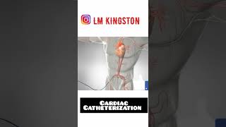 CARDIAC CATHETERIZATION in india [upl. by Endo]