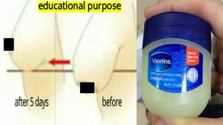 TIGHTEN SAGGING BREAST IN 5 DAYS USING VASELINE AT NIGHT result in demo [upl. by Janyte691]