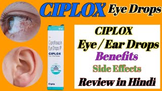 Ciplox Eye  Ear Drops Review in hindi  Ciplox Eye Drops benefitsside effecthealth [upl. by Hsinam]