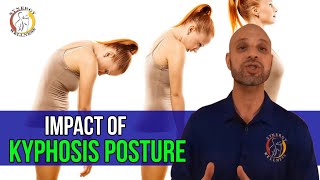 Impact of Kyphosis Posture NYC Chiropractor Bad Posture  Case Study 4 [upl. by Enytsirk]