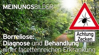 nexworldTV Borreliose Diagnose und Behandlung einer facettenreichen Erkrankung Trailer [upl. by Ylas]