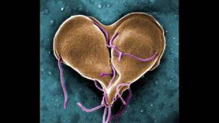 Infectious Disease InfoVid  Giardia [upl. by Gnort]