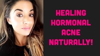 Clearing Hormonal Acne Naturally  LLysine for Acne [upl. by Ahsuatal]