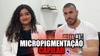 Tudo sobre micropigmentação capilar [upl. by Ailak670]