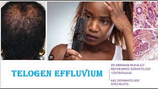 TELOGEN EFLUVIUM EXPLAINED BY DR ABRAHAM educational skincare skindisease hair science [upl. by Nore]