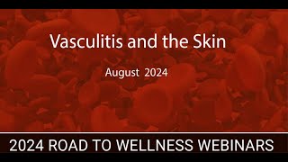 Vasculitis and the Skin [upl. by Ecinrahs]