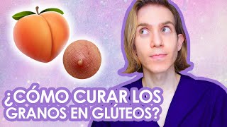 GRANOS en GLUTEOS Causas tratamientos productos para comprar [upl. by Seidnac580]