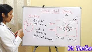 10 VALVULAR HEART DISEASE [upl. by Eugenie]