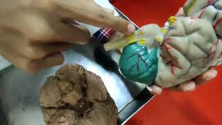 Cerebrum Viscera Bangla Demonstration  Brain Anatomy Bangla  Base Of The Brain [upl. by Kcirrej]