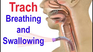 Trach Breathing and Swallowing [upl. by Celestyna]