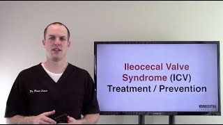 Ileocecal Valve Syndrome Symptoms [upl. by Uttica]